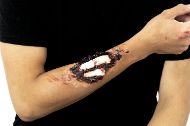 Picture of Compound Fracture